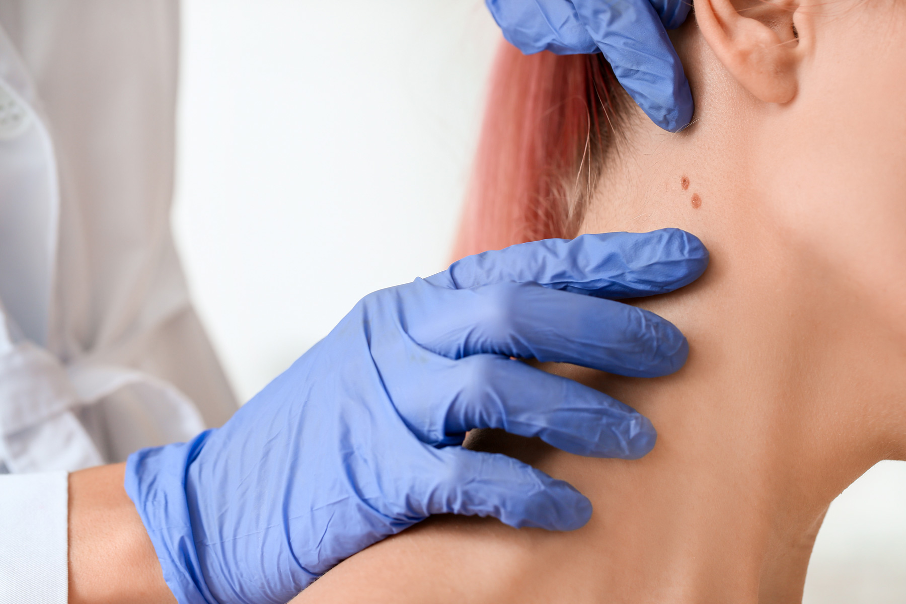 Medico analizza disturbi cutanei paziente